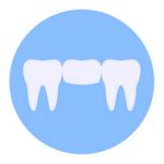 Dental Bridges